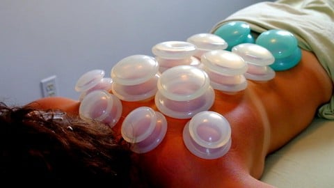 Cupping Massage Mastery (1.5 CEU Credits)